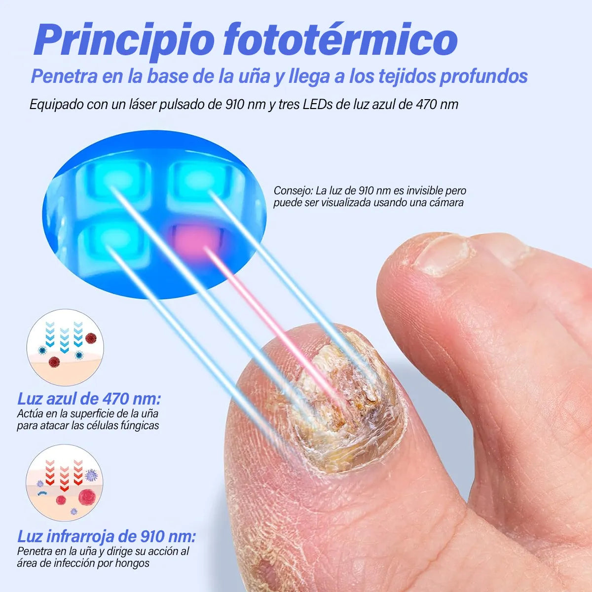 OnyCure™ – Descalzate sin excusas: uñas más claras y presentables en solo 3 semanas. Tecnología profesional UV (+Envío GRATIS)