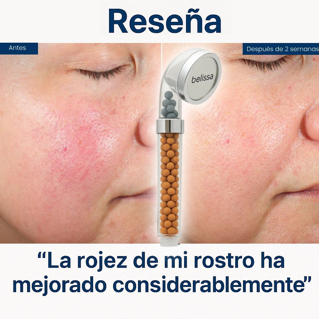 Belissa™ - Di adiós a la irritación en la piel y en el cabello. (+Envío GRATIS)