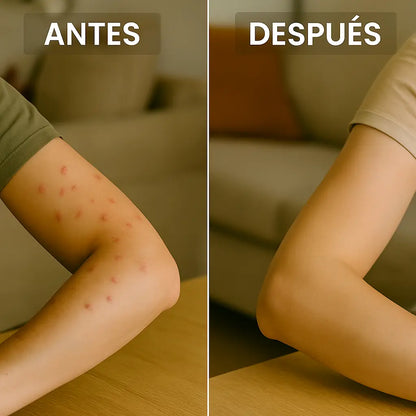 1 + 1 GRATIS | ZenFly™ – El único que elimina mosquitos de verdad sin químicos ni esfuerzo (Tecnología UV 360º)(+Envío GRATIS)